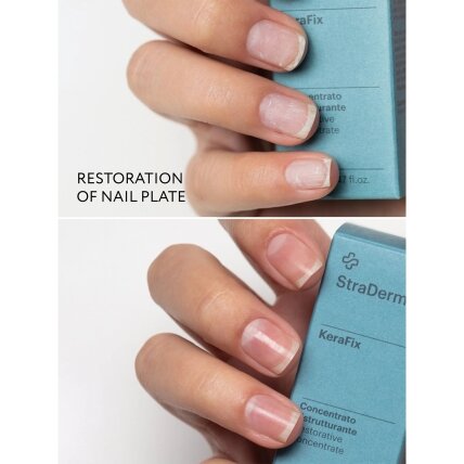 StraDerm pažeistus nagus atstatantis koncentratas KeraFix 14ml 2 StraDerm pažeistus nagus atstatantis koncentratas KeraFix 14ml 2